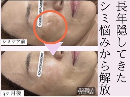 おうちサロン シュシュルームの写真