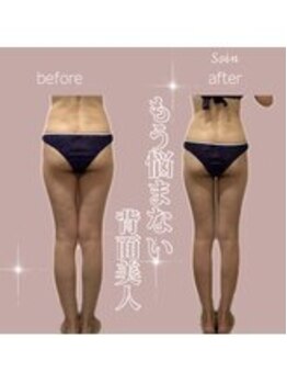ソワン 小岩店(Soin)/ 50代 中半身