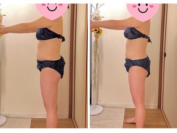 ヨサパーク ココロ 町田店(YOSA PARK COCORO)/Before After