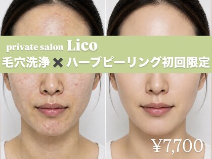 リコ(Lico)の写真