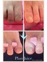 ネイルセラピーサロン プラムジュース(Nail Therapy Salon Plum Juice)/