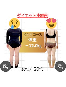 整骨院ひまわり/ダイエット実績例【-12キロ】
