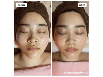 ディアビム(DiAViM)/【コルギ】