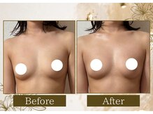 マリン(MARINE)/左右差改善Before→After