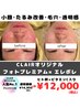 【人気No.1】美肌フォト×美容液導入¥14,850→¥12,000【栄養たっぷりコース】