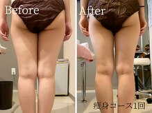 ビューティスト(Beautist)