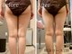 ビューティスト(Beautist)の写真/頑固なヒップまわり、太ももの《脂肪をマシン×熟練ハンド》で徹底ケア!憧れの美ボディをGETしませんか♪
