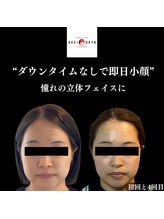 オアシス トウキョウ 川崎店(OASIS TOKYO)/美容鍼×美作矯正×脂肪分解