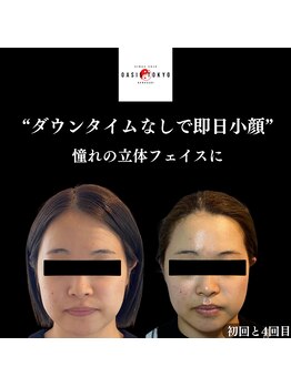 オアシス トウキョウ 川崎店(OASIS TOKYO)/美容鍼×美作矯正×脂肪分解