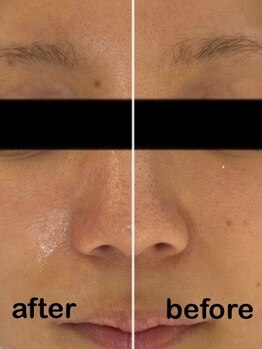 シュガー(Sugar...iyr)/プラズマニア