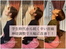 ココクオレ(cocoクオレ)の雰囲気（高額回数券で何十回も行う施術に意味はない！根拠がないから！）