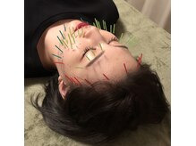 ワセダクラブ 馬込接骨院 鍼灸マッサージ院の雰囲気（美容鍼灸で身体の内側から輝く肌に！）