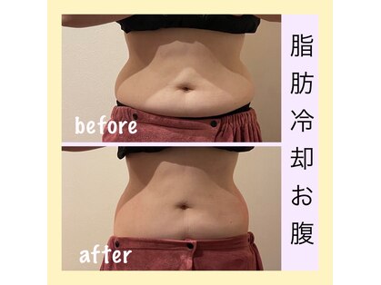 アールアンドエス(R&S)の写真