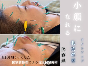 アプレシエ(Apprecier)