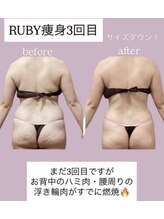 ルビー(RUBY)/更年期の冷え、むくみを改善