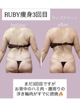 ルビー(RUBY)/更年期の冷え、むくみを改善
