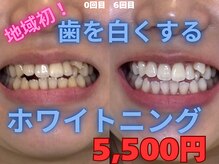 ハロ(halo)