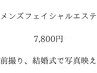 【男性ブライダルメニュー】全顔の光エステ+(毛穴洗浄,ビタミンC導入付き)