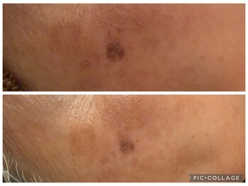 イディアル(IDE'AL)/ハーブ＋生酵素＋シルク