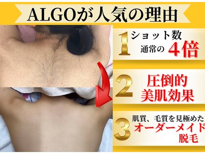 アルゴ 山口宇部店(ALGO)の写真