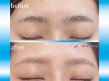 ワンステップ 沼津店(one step)/before after