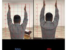 ストレチックス 近江八幡店/BeforeAfter