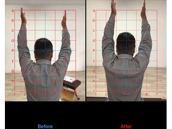 ストレチックス 近江八幡店/BeforeAfter