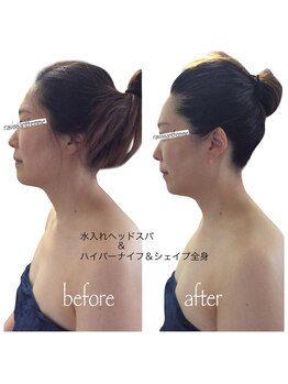 ラヴィソンファム(Ravissant femme)/