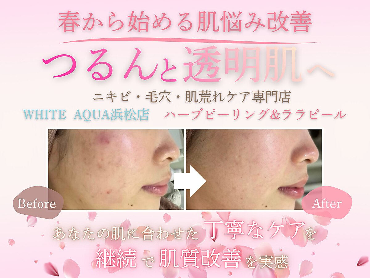 ホワイトアクア 浜松店(WHITE AQUA)｜ホットペッパービューティー
