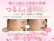 ホワイトアクア 浜松店(WHITE AQUA)
