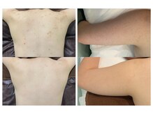 ビオエル 横浜店(Bioel)の雰囲気（肌質・お好みに合わせた商材で施術致します！）