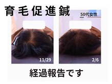 アンスリウム美容整体院 鍼灸院 接骨院/育毛を促す鍼