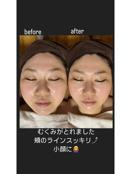 スタジオ オグラ(Studio-Ogura)/ピーリング　イメージ４