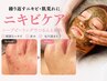 人気No.１【集中ニキビケア】ハーブピーリング+肌質別美容液カスタム/21450→