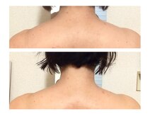 オスマンティエ(Osmantier)の雰囲気（お悩みのたくましく見えてしまうゴツゴツ肩がなだらかに…）