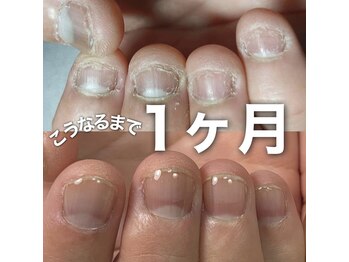 アムレート ネイル 蕨(Amuleto NaiL)/噛む・むしるクセがある方★
