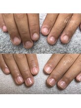 アテナ(ATENA)/深爪補正ジェル担当miho