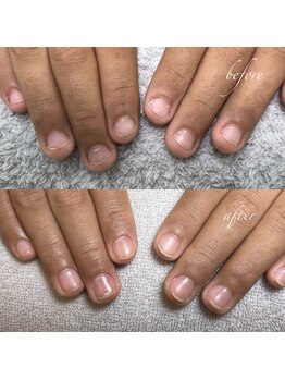 アテナ(ATENA)/深爪補正ジェル担当miho