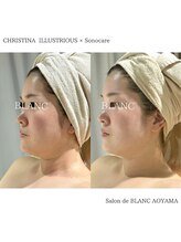 サロン ド ブラン アオヤマ(Salon de BLANC AOYAMA)/イラストリアス90分コース