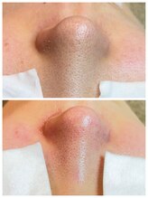 アトレ(Atre)/透明感も爆上がり！！