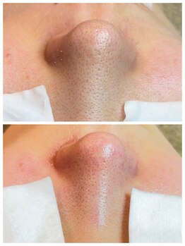 アトレ(Atre)/透明感も爆上がり！！