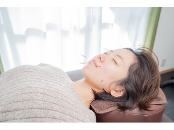 幸鍼灸整体院 武庫之荘院/美顔鍼【むくみ/小顔/武庫之荘】