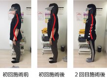 ストラボ 横浜店/ビフォーアフター１０