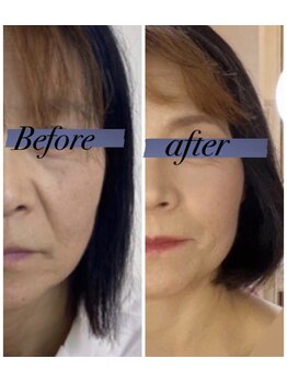 ソルツーサロン マナ(MANA)/覚醒する肌へ