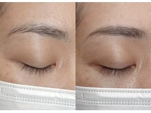 セレン(CELEN)/HBL