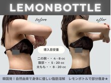 エメ 名古屋栄店(aimer)の雰囲気（レモンボトルで脂肪細胞を分解・排出！理想のボディラインへ◎）