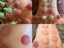 サラン鍼灸院(SARAN都楽鍼灸院)/