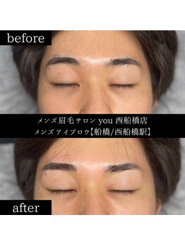 ユー 西船橋店(you)/ビフォーアフター写真