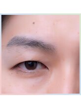 MDラボ 金沢藤江店/こんな状態から卒業出来る