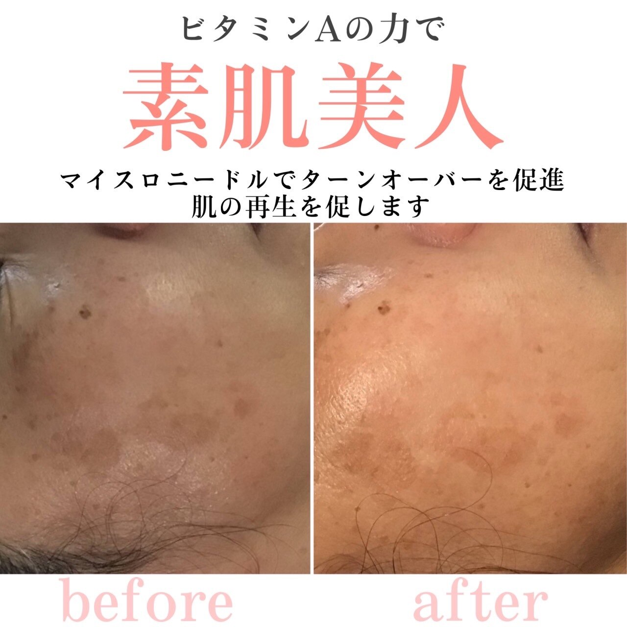 オアシス 船橋店(Oasis)｜ホットペッパービューティー